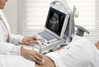Battery design scheme of portable B-ultrasound machine
